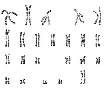 Cariotipo-Sangue-Periferico-Centro-FIV-Mitosi