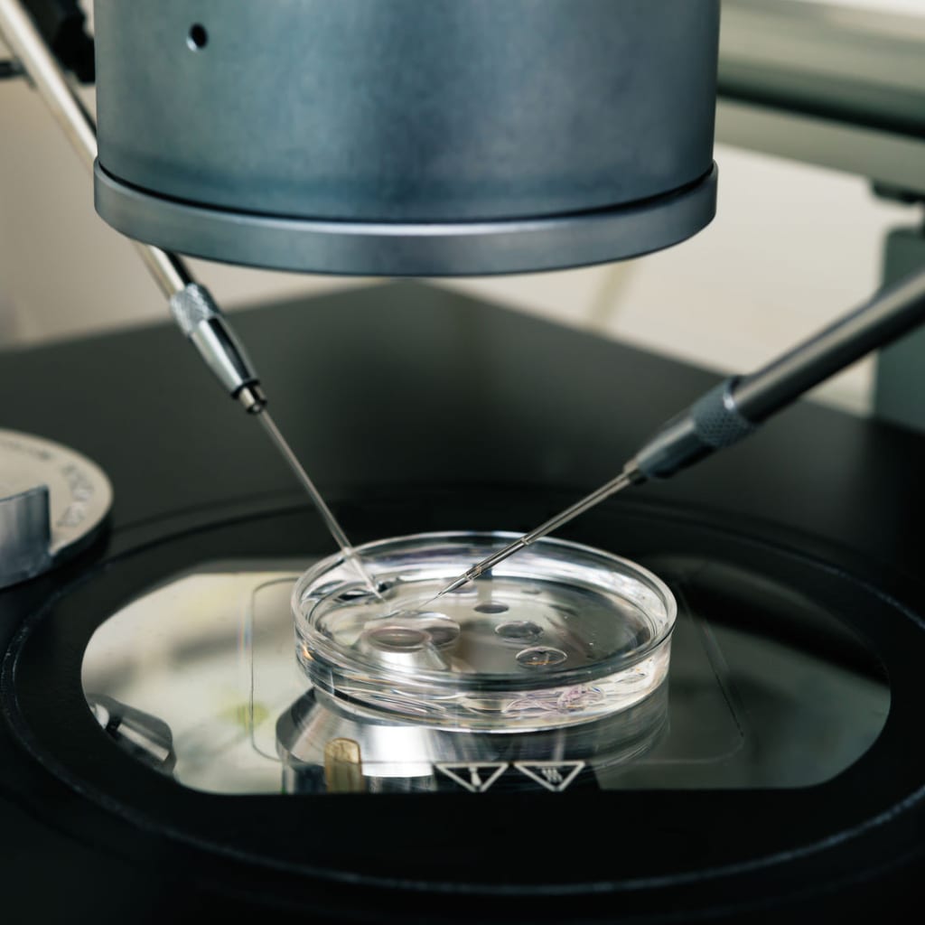 La Fecundación In Vitro - Clinica de Reproduccion Asistida "Mitosi" Grecia