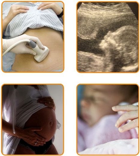 Pregnancy in In Vitro Fertilization Clinic Mitosis