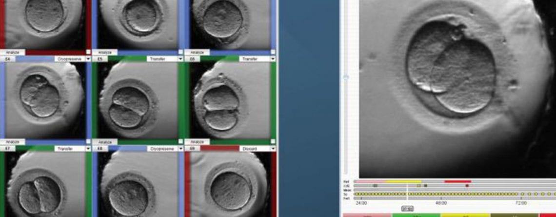 Ο Δρ. Θεοδόσης Αρκουλής αναλύει τις Νεότερες Τεχνικές Αξιολόγησης Εμβρύων