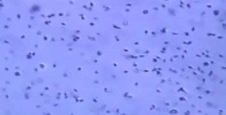 Ο Δρ. Θεοδόσης Αρκουλής μιλά στο Mega για την Σπερματέγχυση