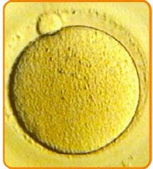 Egg Retrieval - In Vitro Fertilization - Centre FIV Mitosis