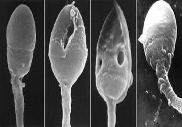 IMSI – New method for choosing the healthiest sperm - In Vitro Fertilization - Centre FIV Mitosis