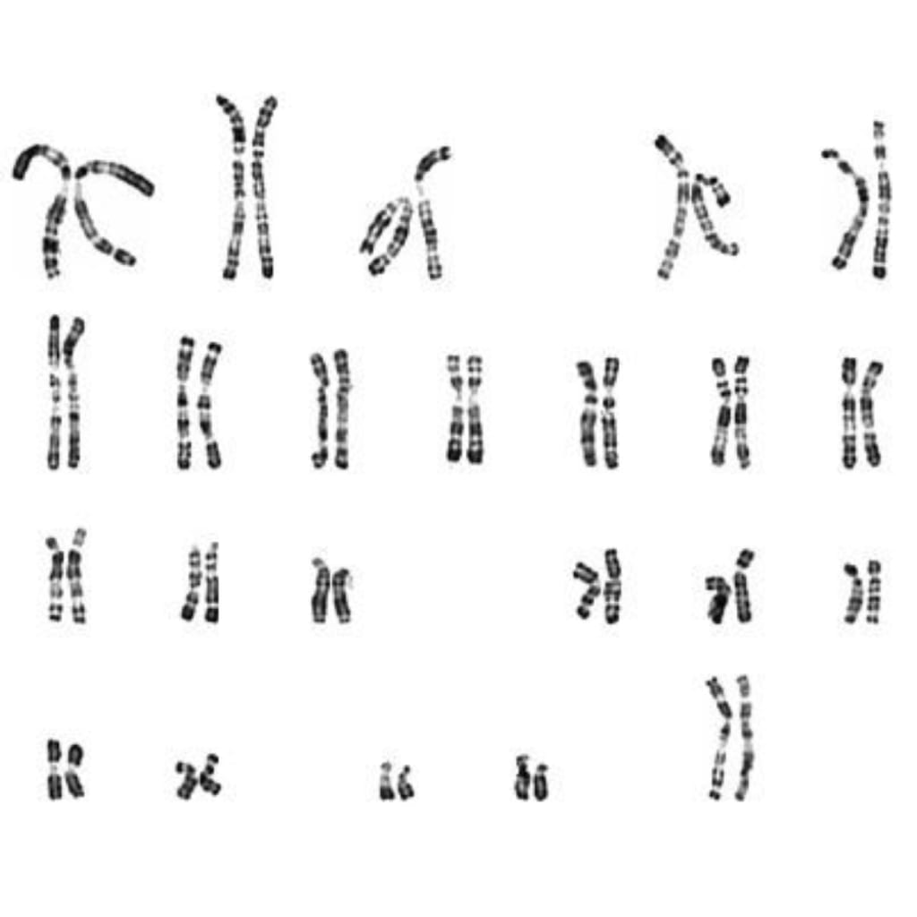 Καρυότυπος Περιφερικού Αίματος - Κέντρο Εξωσωματικής Γονιμοποίησης «Μίτωση»