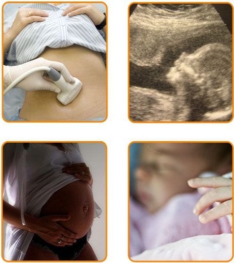 Εγκυμοσύνη, το τελικό βήμα επιτυχίας της Εξωσωματικής Γονιμοποίησης