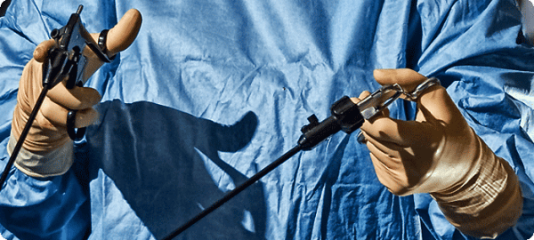 Laparoscopy - In Vitro Fertilization - Centre FIV Mitosis