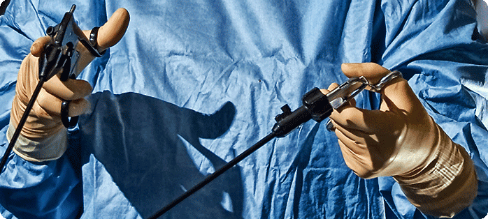 Λαπαροσκόπηση (Διαγνωστική - Επεμβατική) - Κέντρο Εξωσωματικής Γονιμοποίησης «Μίτωση»