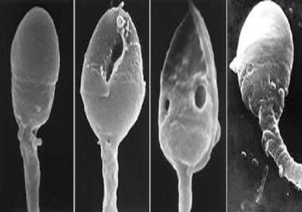IMSI – New method for choosing the healthiest sperm - In Vitro Fertilization - Centre FIV Mitosis