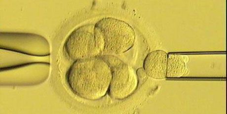 Preimplantation Genetic Diagnosis - In Vitro Fertilization Services - Centre FIV Mitosis