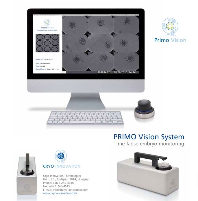 Evaluarea TIME LAPSE a embrionilor - Fertilizare In Vitro - Centrul FIV Mitosis