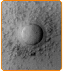 Recoltarea Ovulelor - Centrul de FIV Mitosis