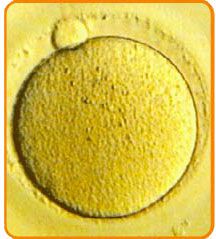 Recoltarea Ovulelor - Centrul de FIV Mitosis