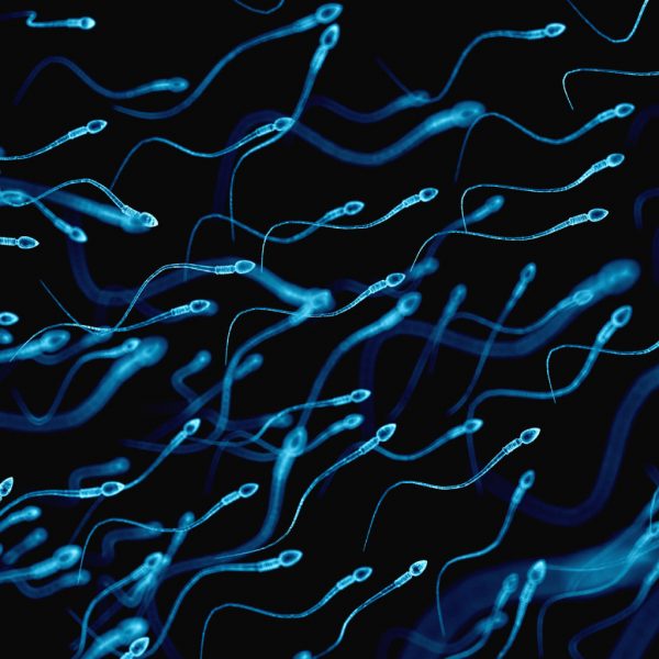 SSR Aspiración Testicular - Centro de Fecundación In Vitro Mitosi