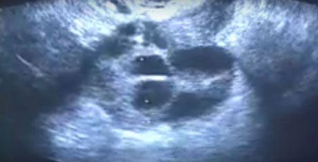 Συνέντευξη του Δρ. Θεοδόση Αρκουλή στην εκπομπή JOY του ANT1