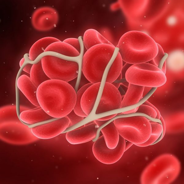 Thrombophilia - Molecular Biology - In Vitro Fertilization Services - Centre FIV Mitosis