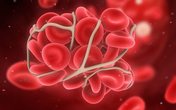 Thrombophilie - Biologie Moléculaire - Centre de Fertilité FIV MITOSIS