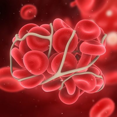 Thrombophilie - Centre de Fécondation in Vitro - Mitosis