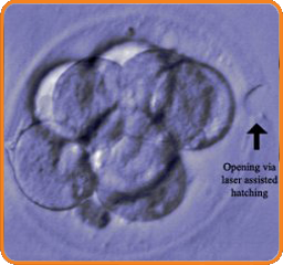 Έμβρυο 2ης ημέρας - Υποβοηθούμενη Εκκόλαψη - Κέντρο Εξωσωματικής Γονιμοποίησης Μίτωση