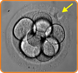 2PN Ελεγχος Γονιμοποίησης 1η μέρα - Υποβοηθούμενη Εκκόλαψη - Κέντρο Εξωσωματικής Γονιμοποίησης Μίτωση