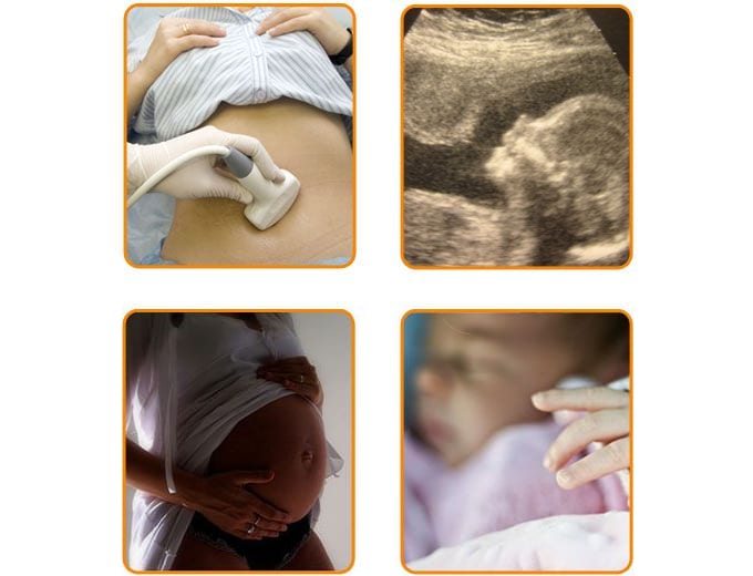 Accompagne La Femme - Grossesse - Fécondation - Centre de Fertilité FIV MITOSIS