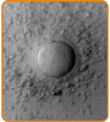 Eizellenentnahme - Zentrum IVF Mitosis