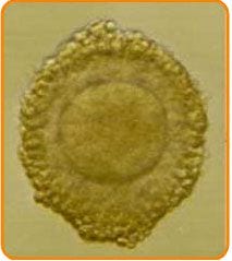 Eizellenentnahme - Zentrum IVF Mitosis