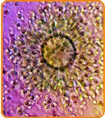 Eizellenentnahme - Zentrum IVF Mitosis