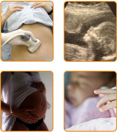 Gravidanza - Centro di Fecondazione Assistita Mitosis