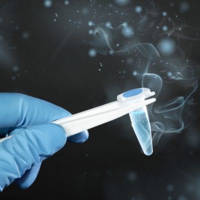 In Vitro Fertilisation Intrauterine Insemination Heterologem Spendersperma - Zentrum-IVF-Mitosis-Griechenland