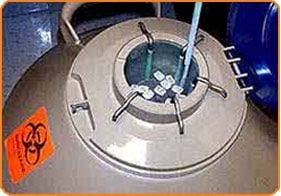 Sperm Cryopreservation - In Vitro Fertilization - Centre FIV Mitosis